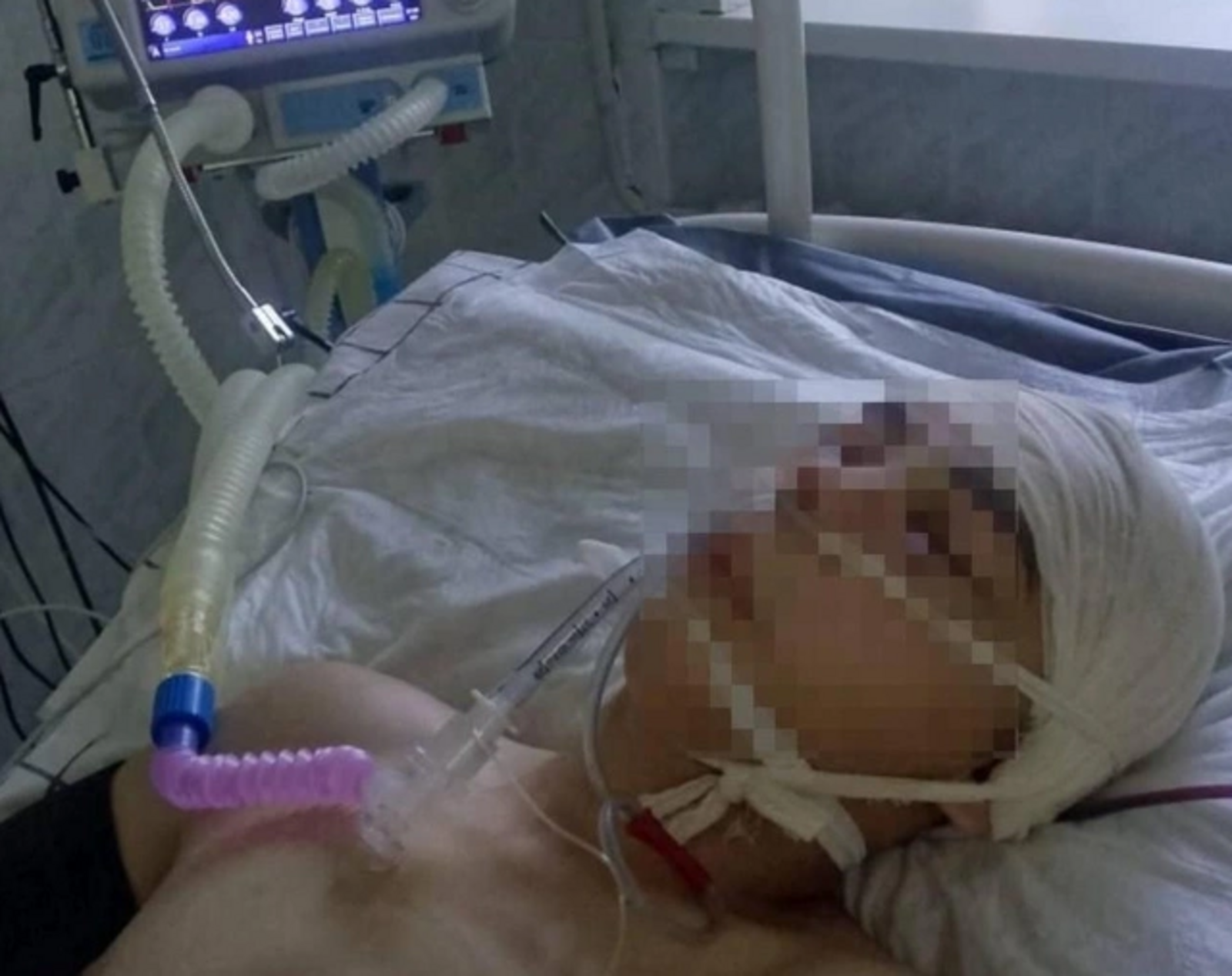 СКР возбудил уголовное дело по факту избиения подростка из Башкирии